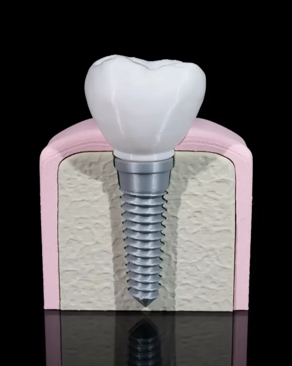 Mokomasis modelis Implantas