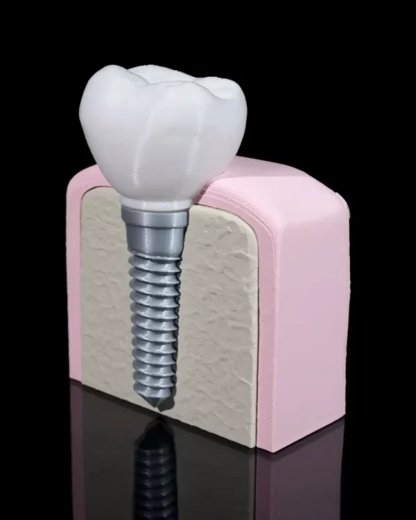 Mokomasis modelis Implantas